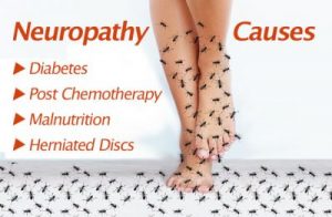 neuropathy causes