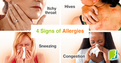 allergic reaction signs