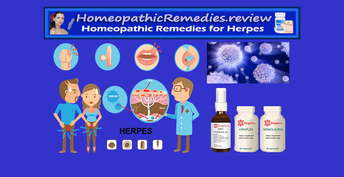 natural remedies for herpes