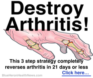 homeopathic remedies for arthritis