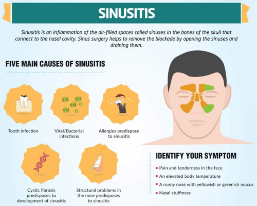 what can cause a sinus infection