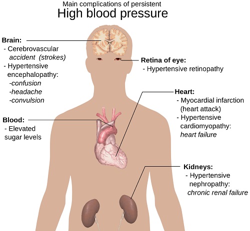 hypertension risk factors